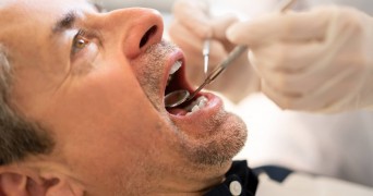 Medicare Coverage for Dental Care Services & Treatments
