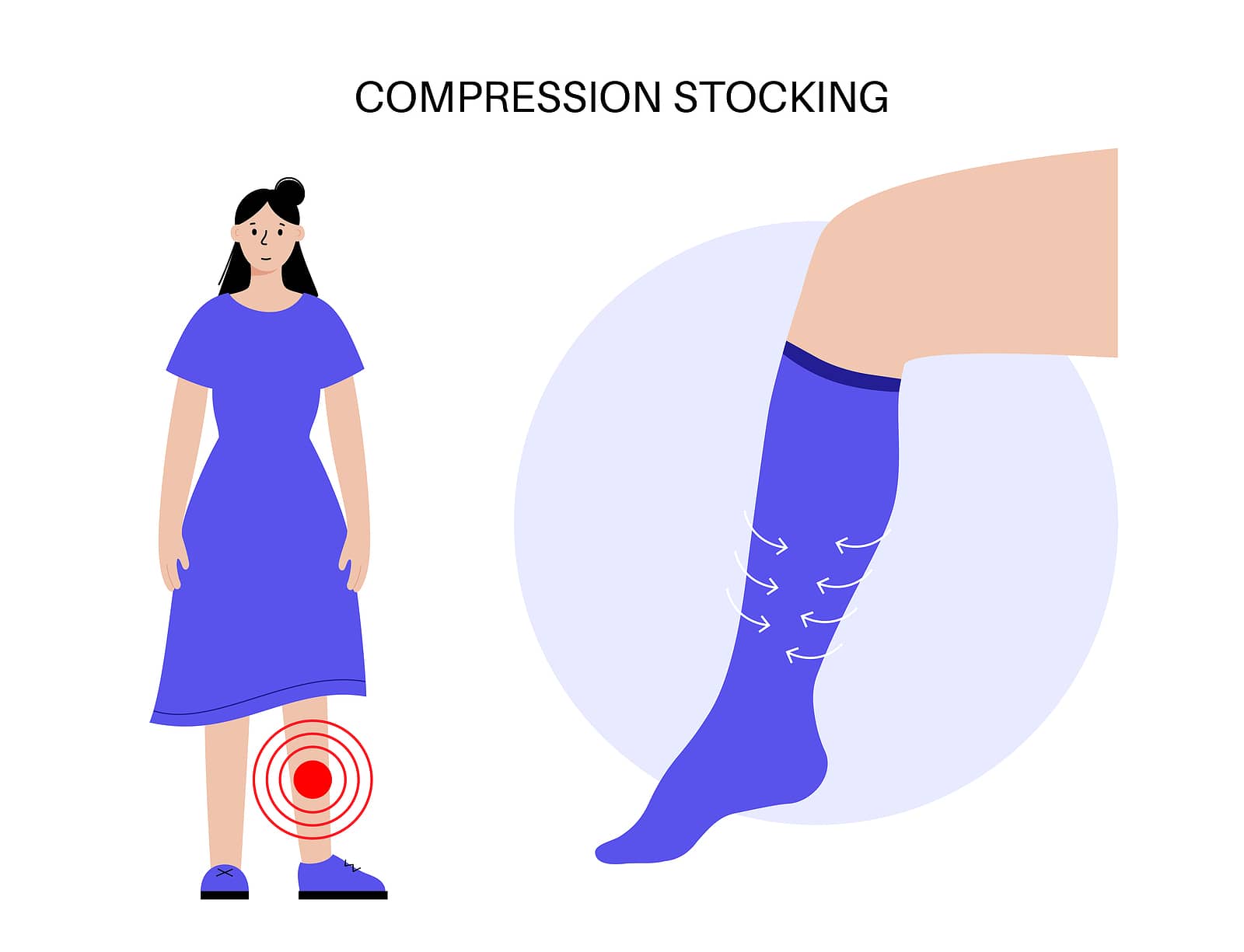 Comparison of primary diseases between graduated compression